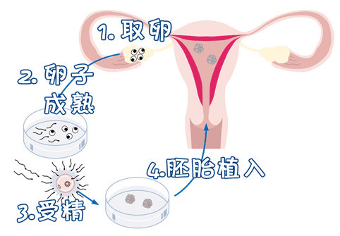 冷冻设备